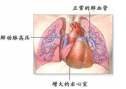 药物流产预防措施